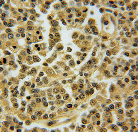 TNFAIP8L2 antibody|TNFAIP8L2抗体