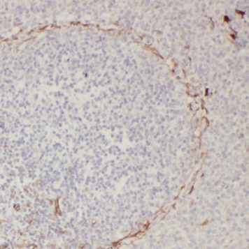 SLC35A1 antibody|SLC35A1抗体