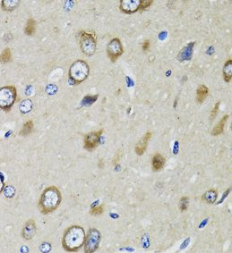 RPS10 antibody|RPS10抗体