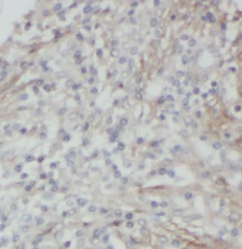 DSP antibody|DSP抗体