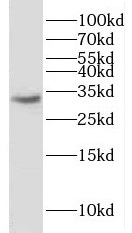 Histone H1.0 antibody|Histone 