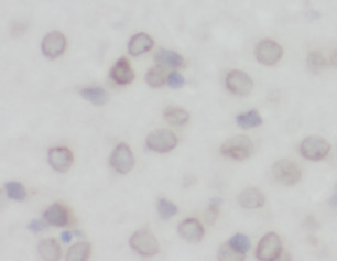 DLG4-Specific antibody|DLG4抗体