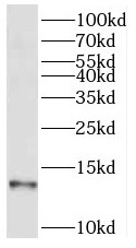 SEC61B antibody|SEC61B抗体 FNab0