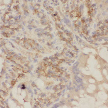 SHARPIN antibody|SHARPIN抗体 FNa