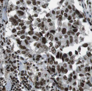 HYAL2 antibody|HYAL2抗体 FNab040