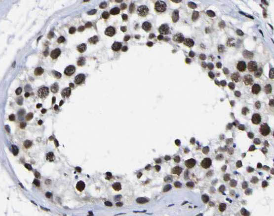 PARP11 antibody|PARP11抗体
