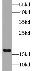 UBE2C antibody|UBE2C抗体 FNab091
