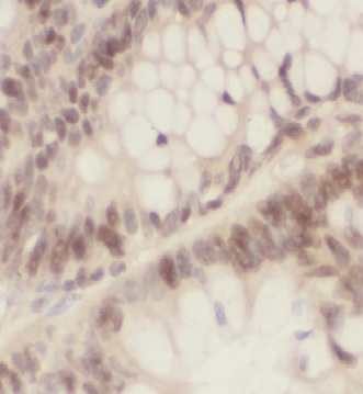 OLA1 antibody|OLA1抗体