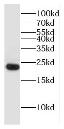 DNAJC5B antibody|DNAJC5B抗体