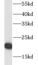 RPL18A antibody|RPL18A抗体 FNab0