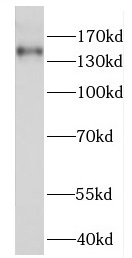 FANCI antibody|FANCI抗体