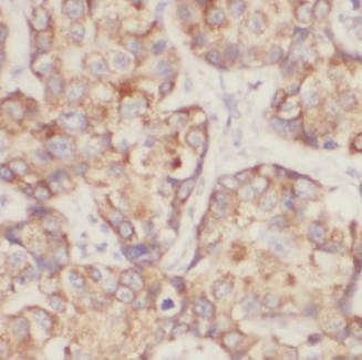EIF4E antibody|EIF4E抗体 FNab013