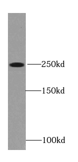 RYR2 antibody|RYR2抗体
