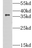 CLYBL antibody|CLYBL抗体