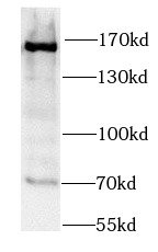 SMC1A antibody|SMC1A抗体
