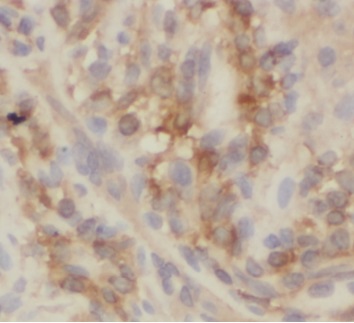 VIL1 antibody|VIL1抗体 FNab09407