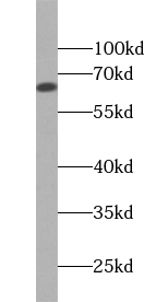 ZKSCAN8 antibody|ZKSCAN8抗体
