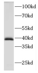 DNAJB2 antibody|DNAJB2抗体