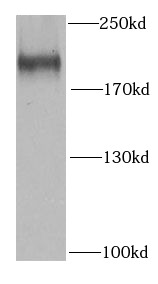 SETDB1 antibody|SETDB1抗体