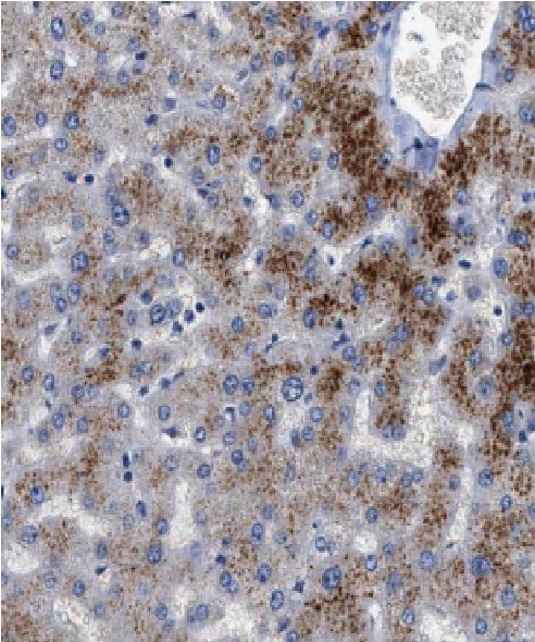 F12 antibody|F12抗体 FNab02938