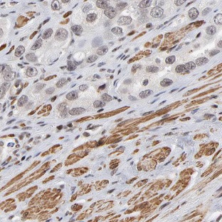 MARCKS antibody|MARCKS抗体 FNab0