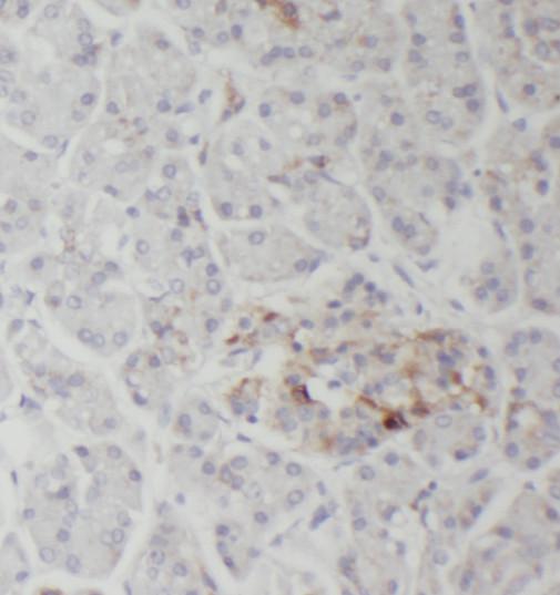 RNASET2 antibody|RNASET2抗体