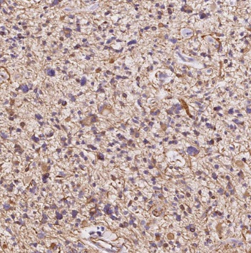 TRIM44 antibody|TRIM44抗体 FNab0