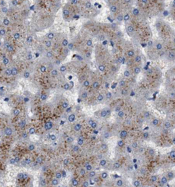 CRHR2 antibody|CRHR2抗体