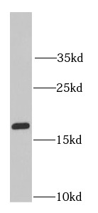 RPS10 antibody|RPS10抗体
