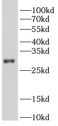 Bcl-XL antibody|Bcl-XL抗体
