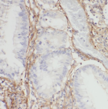 SUCLA2 antibody|SUCLA2抗体
