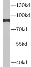 ITGB7 antibody|ITGB7抗体