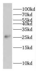 EIF1AD antibody|EIF1AD抗体