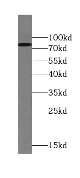 TSNAXIP1 antibody|TSNAXIP1抗体