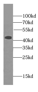 HBZ-Specific antibody|HBZ抗体