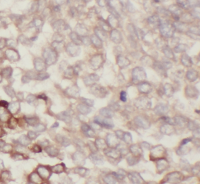PRDX3 antibody|PRDX3抗体 FNab068