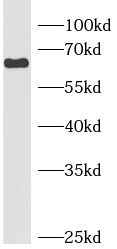 HLF antibody|HLF抗体