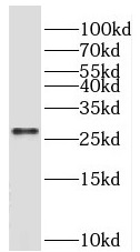 BEX3 antibody|BEX3抗体