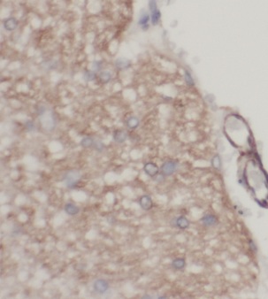 KLHL21 antibody|KLHL21抗体