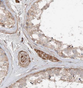 TMX3 antibody|TMX3抗体