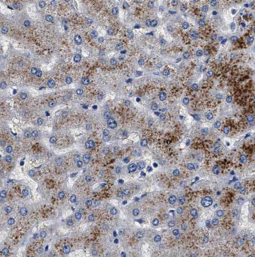 TIMM22 antibody|TIMM22抗体