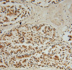 DHX36 antibody|DHX36抗体