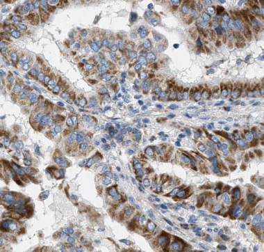 LHCGR antibody|LHCGR抗体