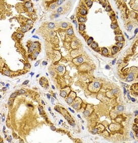 BMP15 antibody|BMP15抗体