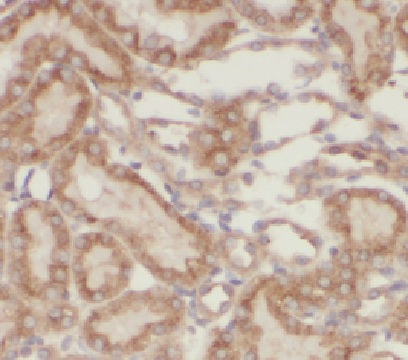 HERPUD2 antibody|HERPUD2抗体