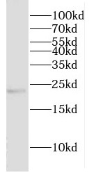 CRYBA2 antibody|CRYBA2抗体