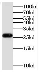 KCNE4 antibody|KCNE4抗体