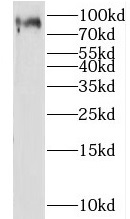 P3H3 antibody|P3H3抗体