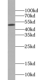 PARP15 antibody|PARP15抗体