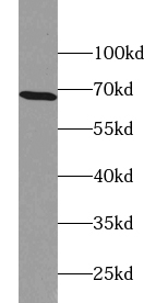 ACBD5 antibody|ACBD5抗体